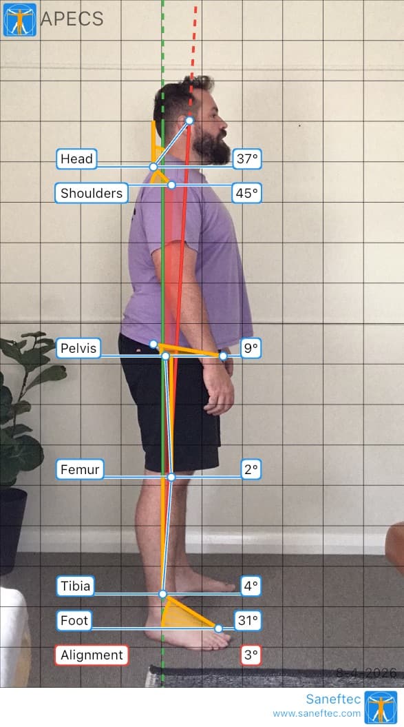 Posture & Desk Pain