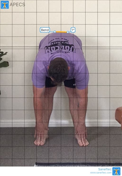 Forward bend analysis at Elvin Chiropractic