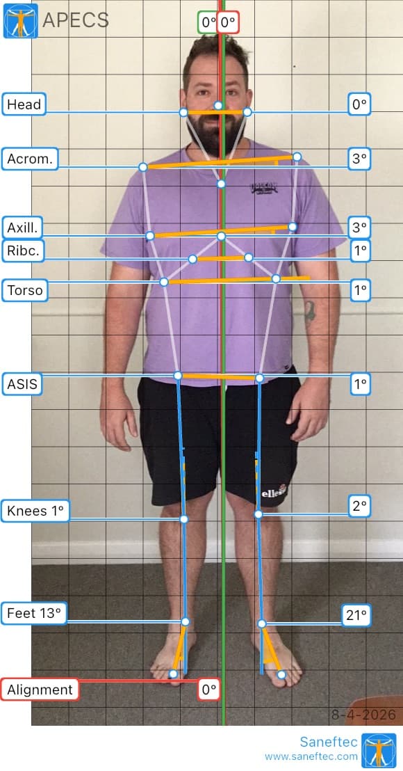 Front posture analysis at Elvin Chiropractic
