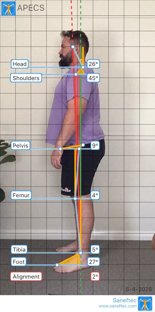 Side posture analysis at Elvin Chiropractic